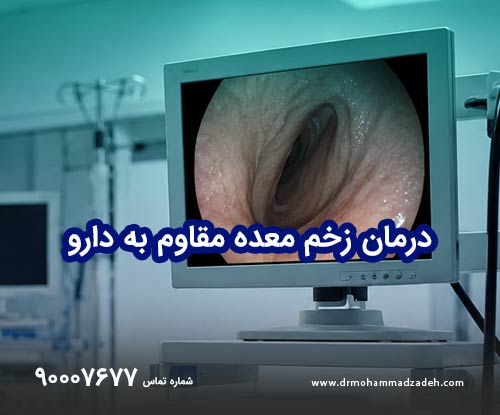 درمان زخم معده مقاوم به دارو با آندوسکوپی