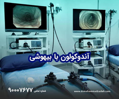 آندوکولون با بیهوشی